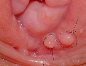 女生尿道图片,结构特点与生理功能解析